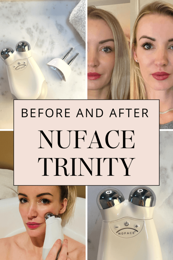 Nuface jawline before after