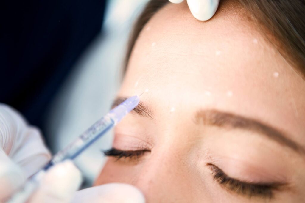 Benefits of Botox treatment