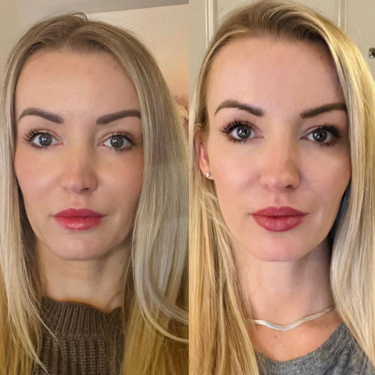 Nuface Before and After Results