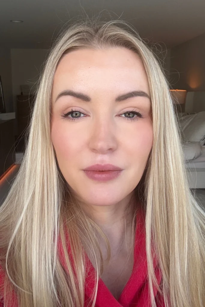 Blepharoplasty surgery  cost